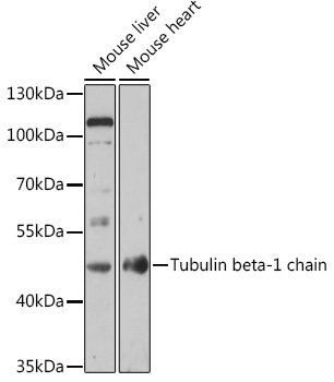 Tubulin beta-1 chain Rabbit pAb