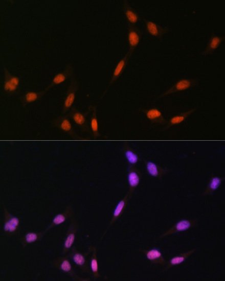 MonoMethyl-Histone H4-K5 Rabbit pAb
