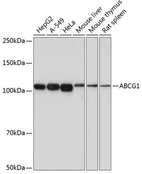ABCG1 Rabbit mAb
