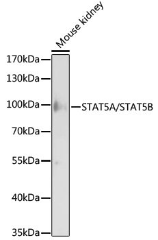 STAT5A/STAT5B Rabbit pAb