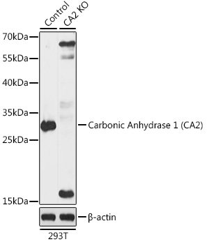 [KO Validated] Carbonic Anhydrase 2 (CA2) Rabbit pAb