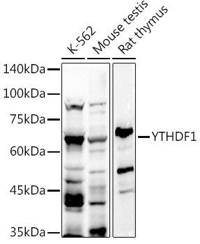 YTHDF1 Rabbit pAb