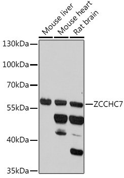 ZCCHC7 Rabbit pAb