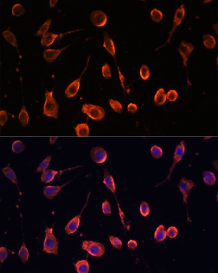 MT-ATP6 Rabbit pAb