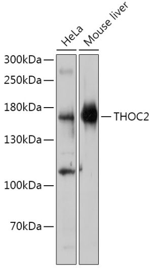 THOC2 Rabbit pAb