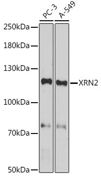 XRN2 Rabbit pAb
