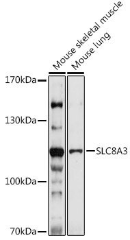 SLC8A3 Rabbit pAb