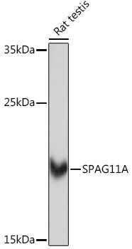 SPAG11A Rabbit pAb