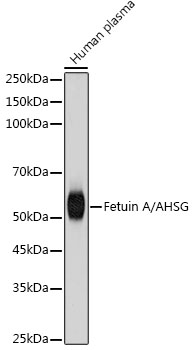 Fetuin A/AHSG Rabbit mAb
