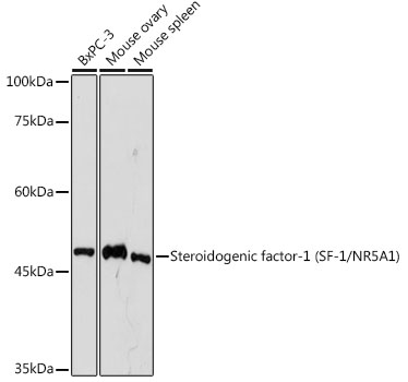 Steroidogenic factor-1 (SF-1/NR5A1) Rabbit mAb