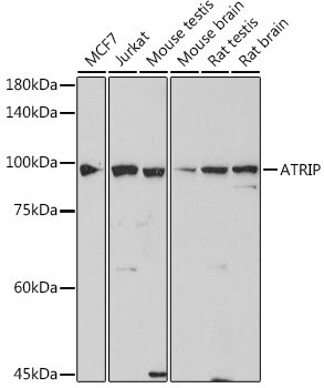 ATRIP Rabbit mAb