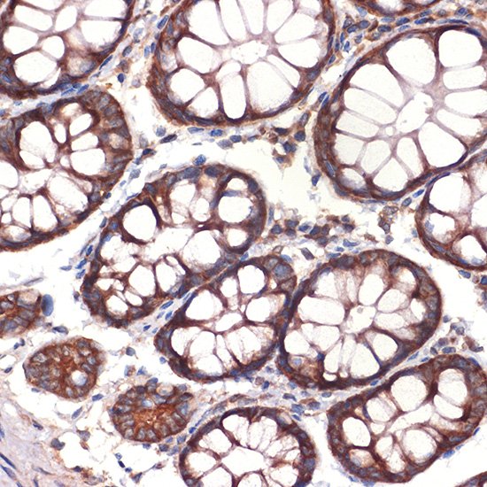 CC2D1A Rabbit mAb