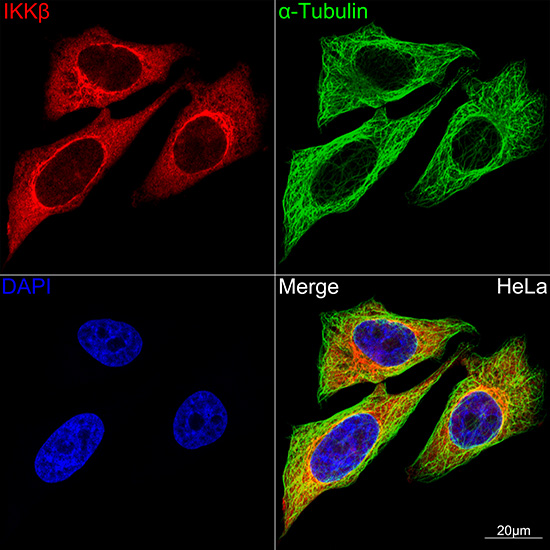 IKKβ Rabbit mAb