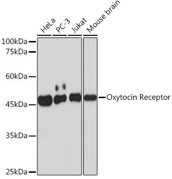 Oxytocin Receptor Rabbit mAb