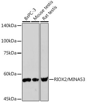 RIOX2/MINA53 Rabbit mAb