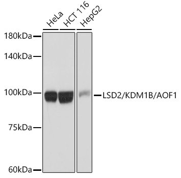 LSD2/KDM1B/AOF1 Rabbit mAb
