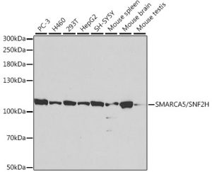 SMARCA5/SNF2H Rabbit pAb