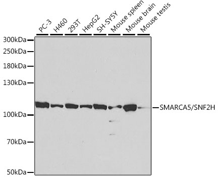 SMARCA5/SNF2H Rabbit pAb