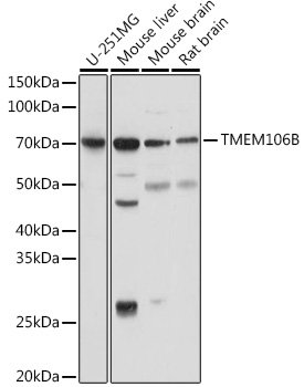 TMEM106B Rabbit pAb