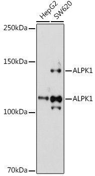 ALPK1 Rabbit pAb