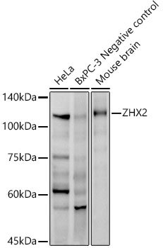 ZHX2 Rabbit mAb