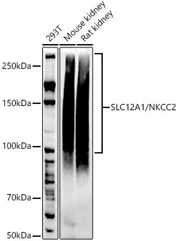 SLC12A1 / NKCC2 Rabbit mAb