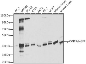 p75NTR/NGFR Rabbit pAb