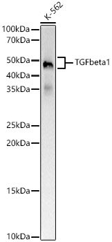 TGF beta 1 Rabbit mAb