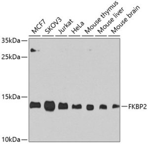 FKBP2 Rabbit pAb