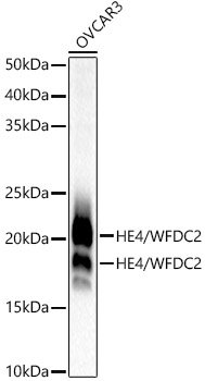 HE4/WFDC2 Rabbit mAb
