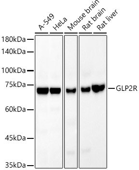 GLP2R Rabbit mAb