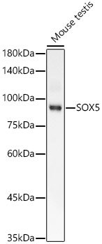 SOX5 Rabbit mAb
