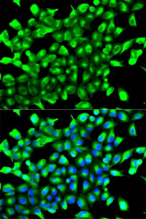 PHD2/EGLN1 Rabbit pAb