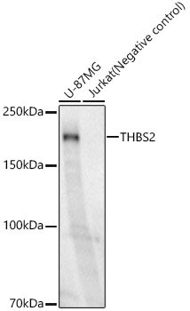 THBS2 Rabbit mAb