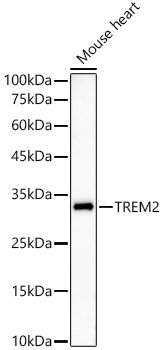 TREM2 Rabbit mAb