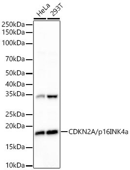 CDKN2A/p16INK4a Rabbit mAb