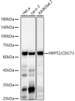 HRPT2 / CDC73 Rabbit mAb