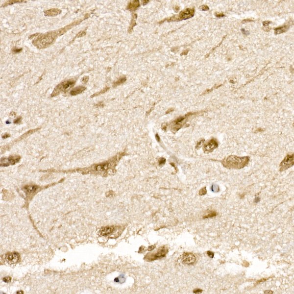 SOCS7 Rabbit mAb