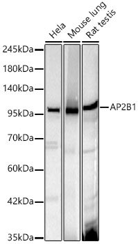 AP2B1 Rabbit mAb
