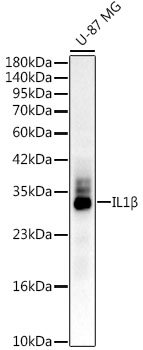 IL1β Rabbit mAb