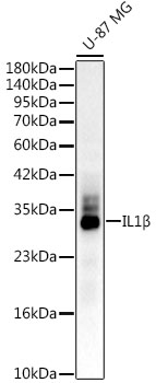 IL1β Rabbit mAb