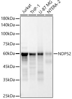 NDP52 Rabbit mAb