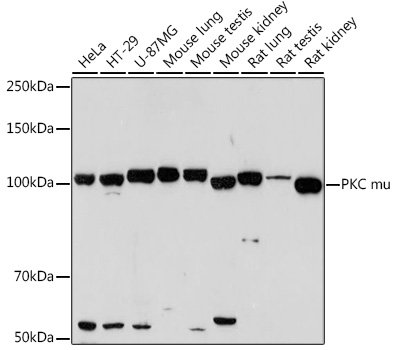 PKC mu Rabbit mAb