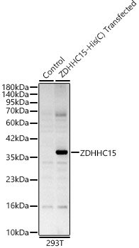 ZDHHC15 Rabbit pAb