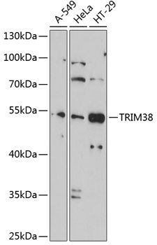 TRIM38 Rabbit pAb