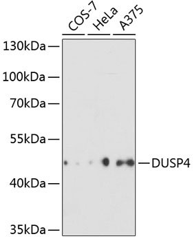 DUSP4 Rabbit pAb