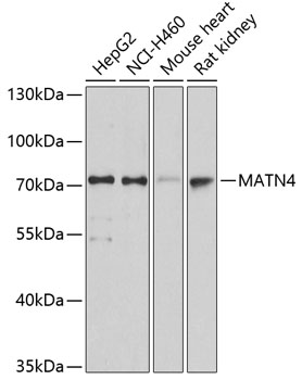MATN4 Rabbit pAb