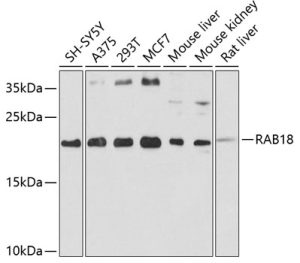 RAB18 Rabbit pAb