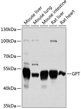 GPT Rabbit pAb