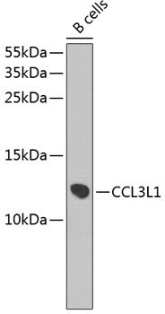 CCL3L1 Rabbit pAb